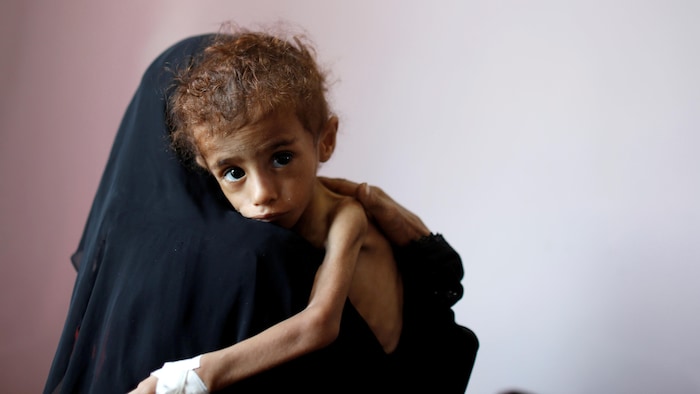  Plus de 5 millions d'enfants menacés par la famille au Yémen selon l'organisme Save the children