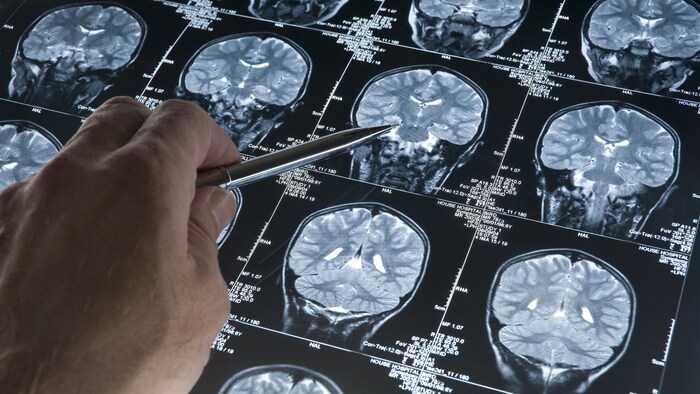 Des radiographies d'un cerveau