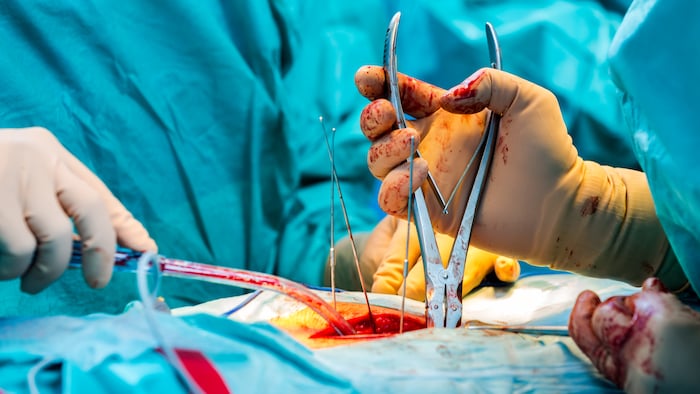 Tout le processus menant à une transplantation est très complexe et nécessite une coordination colossale.