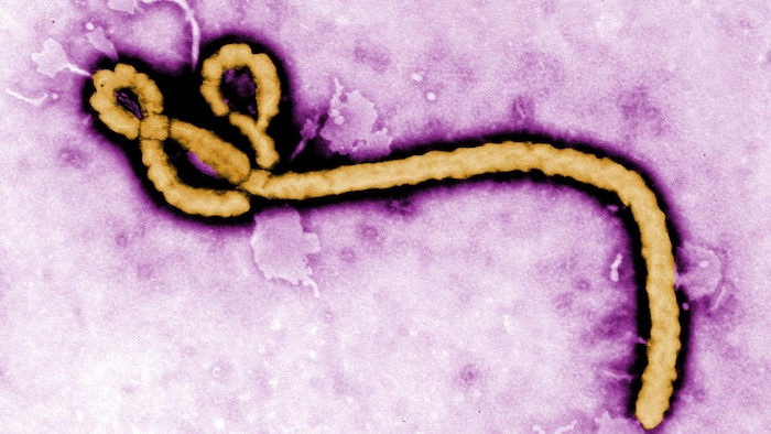 埃博拉（Ebola）病毒。
