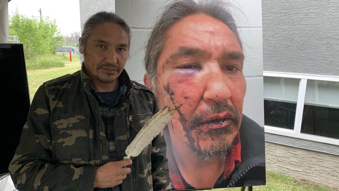 Le chef Allan Adam se tient à côté une photo de son visage tuméfié. Il tient une plume dans sa main. 