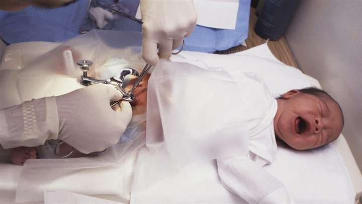 Circoncision