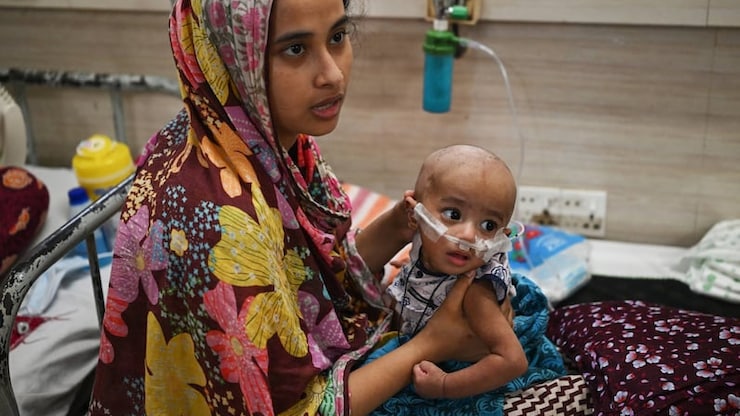バングラデシュ、世界最悪の麻疹流行に直面、過去6か月で1,000人が死亡