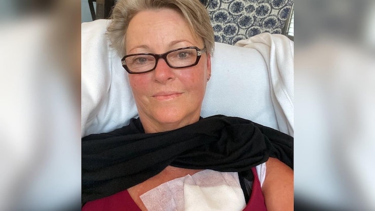 Some breast cancer patients may not need radiation, new Canadian ...