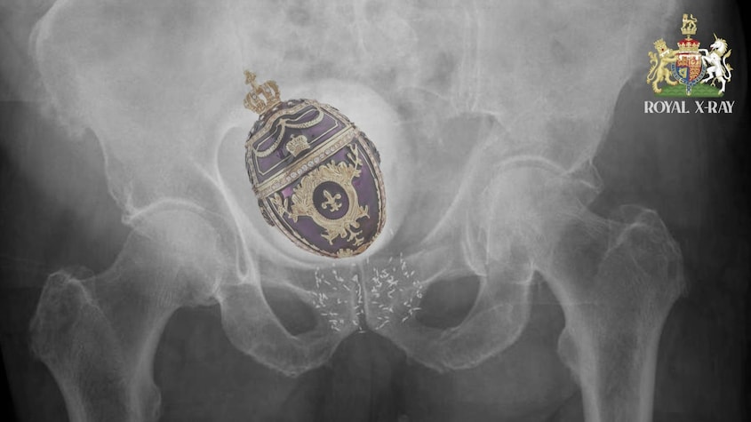 Un oeuf Fabergé royal vu dans le scan au rayon x d'un bassin.