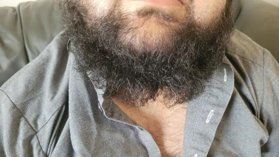 La partie basse du visage de la victime avec une barbe coupée.