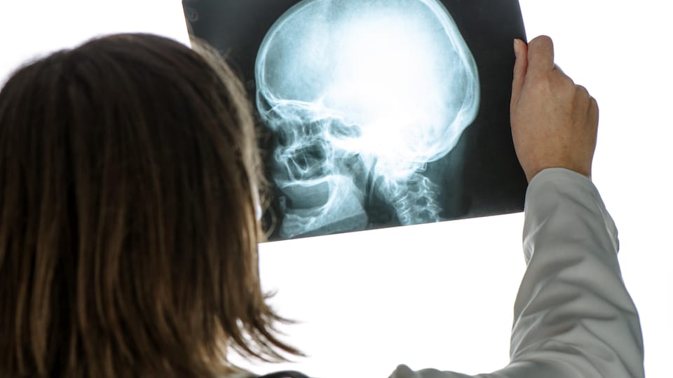 Médecin analysant une radiographie du crâne humain au bureau de l'hôpital pendant l'examen médical.