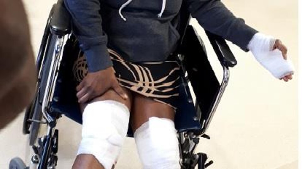 La mère de famille est dans une chaise roulante et porte des bandages aux genoux et à la main gauche.
