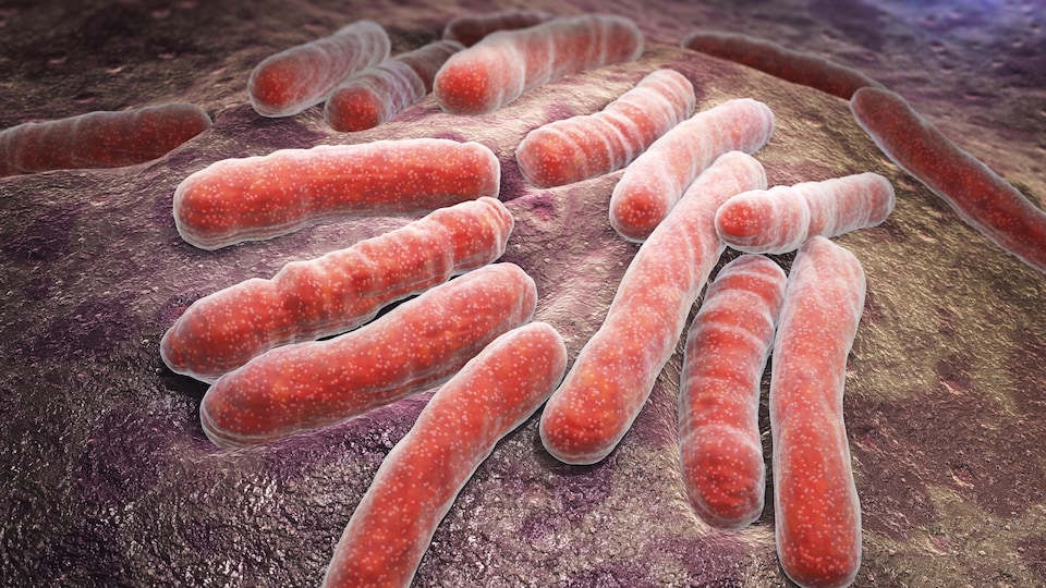 La bactérie de la tuberculose.