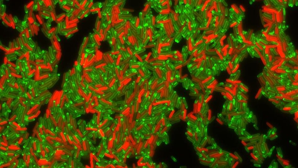 On voit des centaines de bactéries au microscope.