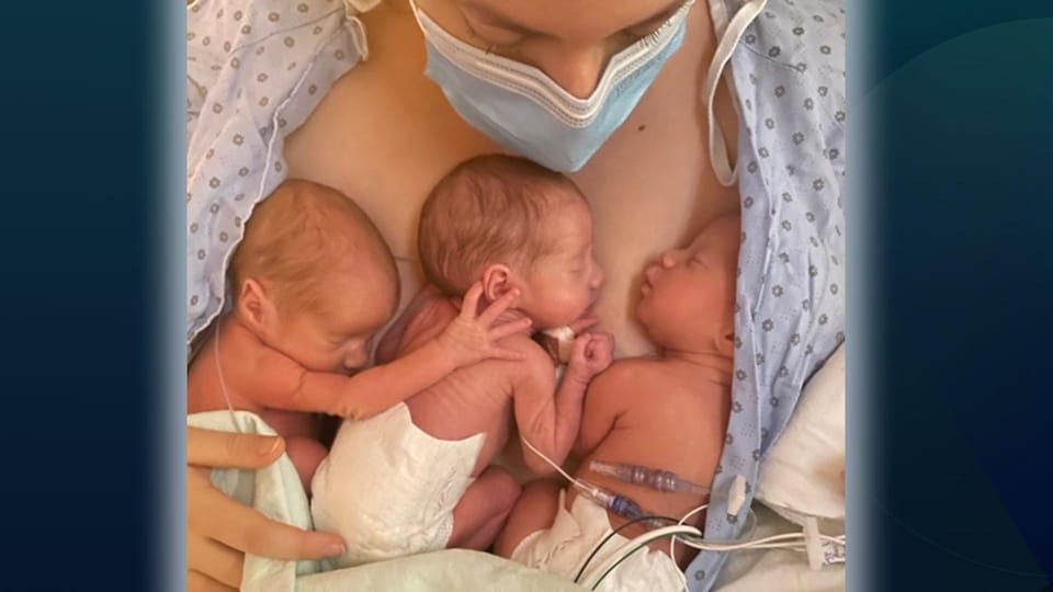 Trois petits bébés dorment sur leur mère dans un lit d'hôpital.