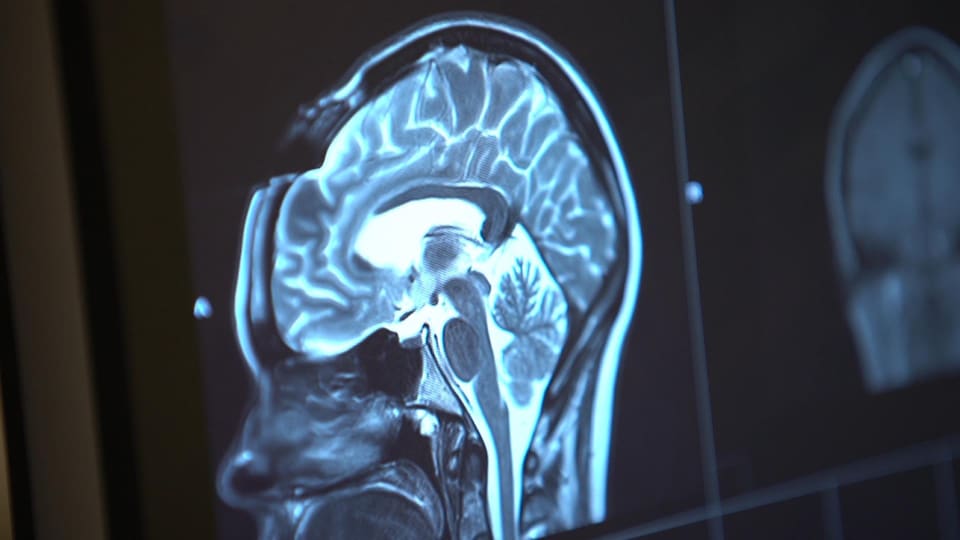 Radiographie du cerveau.