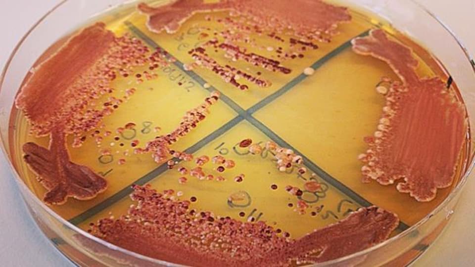 Une colonie de levure Candida rouge en croissance. 