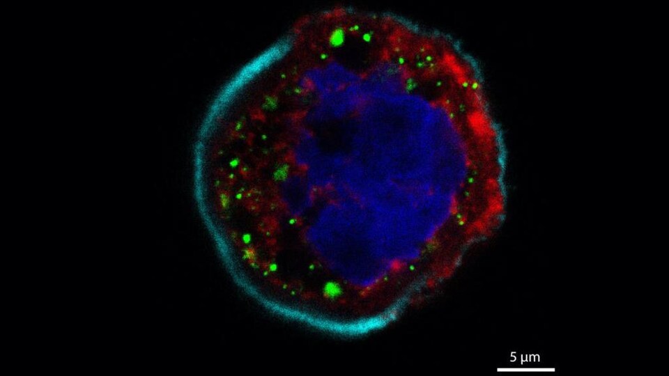 une image d'une cellule infectée par la COVID-19.