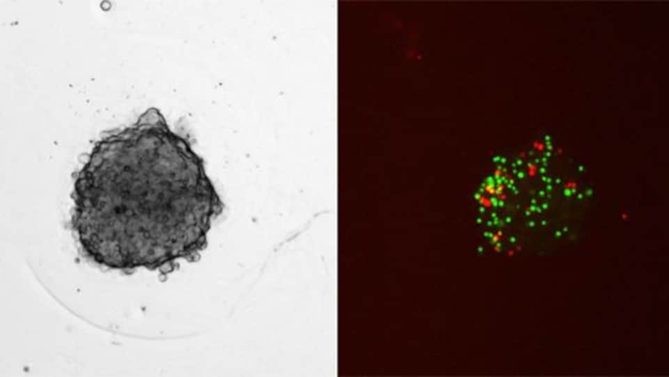Des cellules immunitaires marquées par fluorescence.