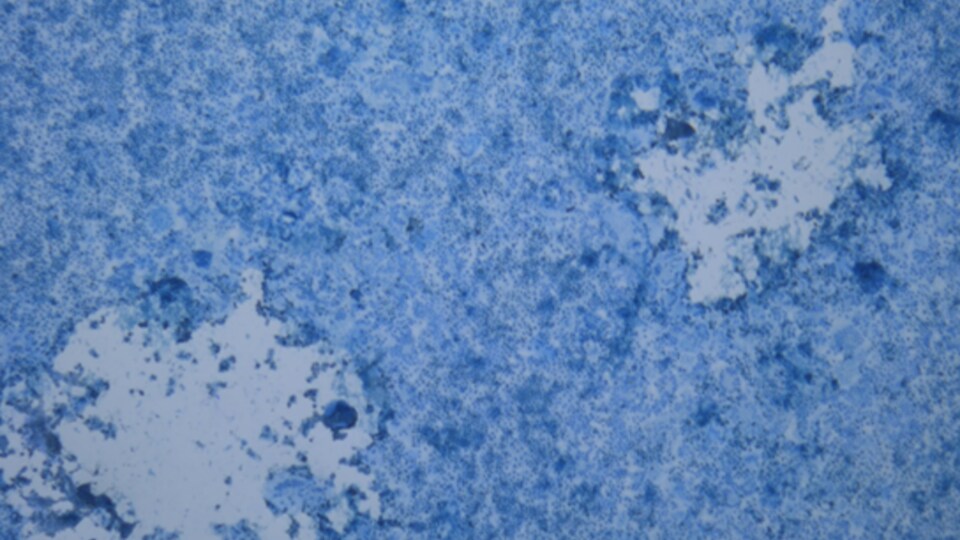 Représentation de cellules infectées observées par microscope.
