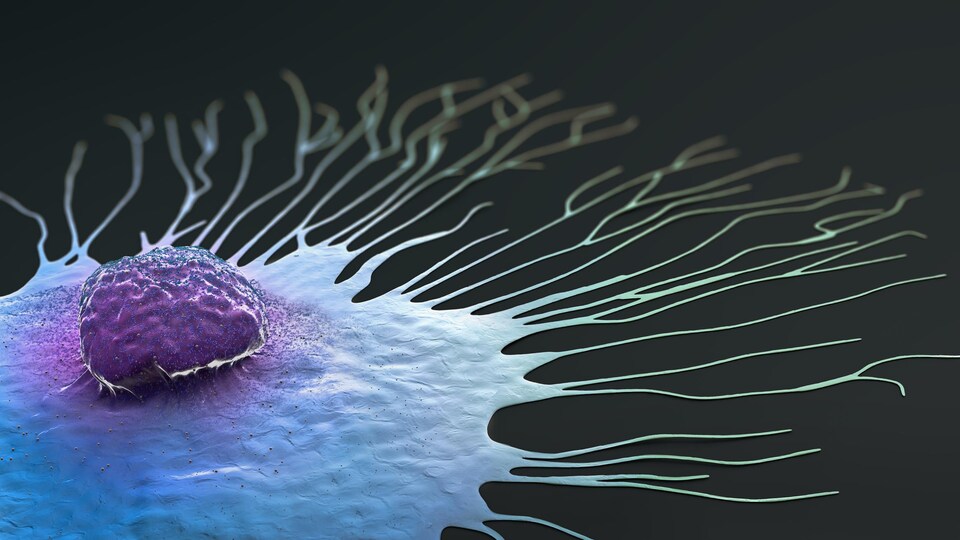 Illustration montrant une cellule cancéreuse du sein.