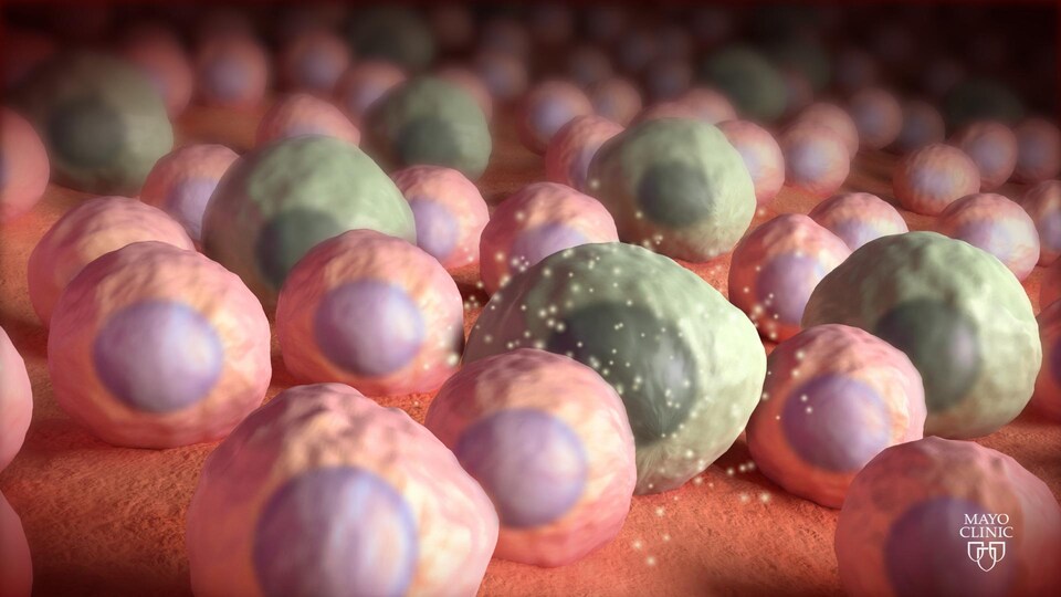 Représentation artistique de cellules sénescentes.
