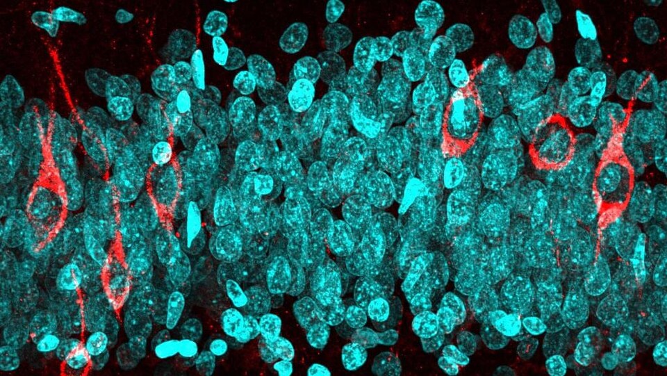 Vue microscopique des tissus sains du cerveau d'un homme mort à 68 ans.