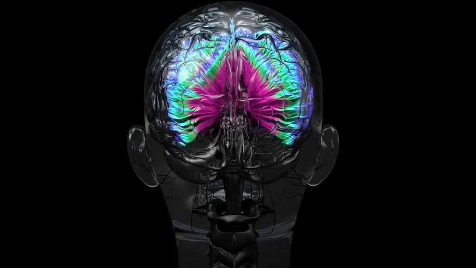 IRM colorée d'un cerveau humain.