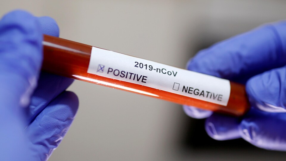 Un échantillon de sang positif à la COVID-19 contenu dans une éprouvette.