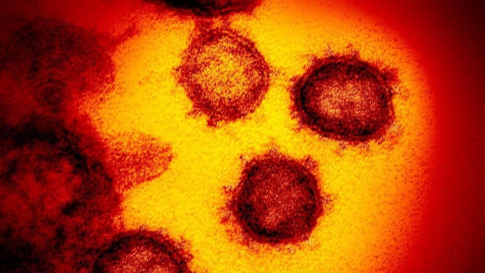 Image provenant d'un microscope électronique du coronavirus SARS-CoV-2