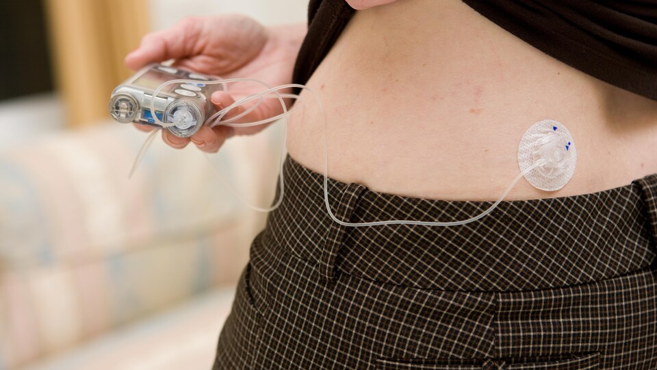 Une personne dont on ne peut voir que la taille vérifie l'écran de sa pompe à insuline.