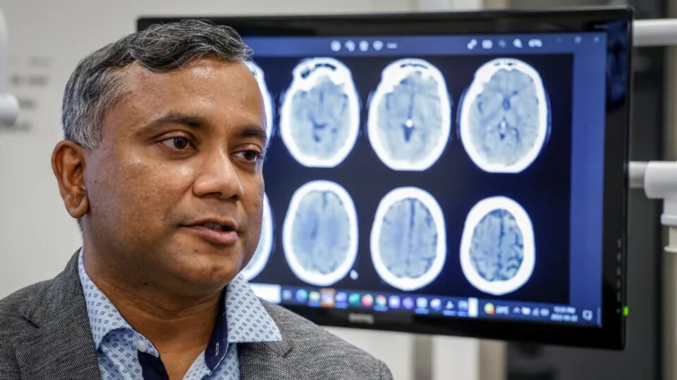 Le Dr Bijoy Menon devant des radiographies d'un cerveau.