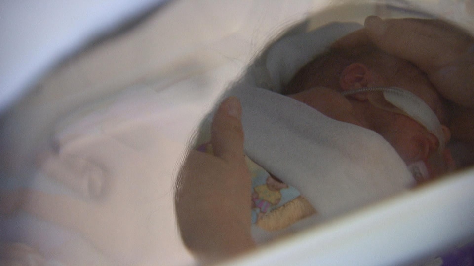 L Acces A Une Garderie Change La Vie D Un Enfant Handicape Radio Canada Ca