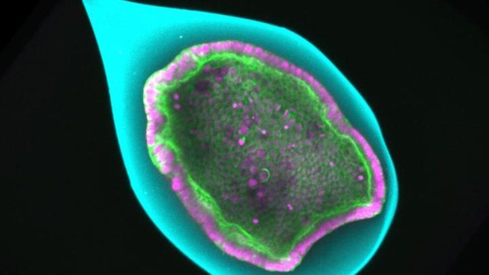 Une sphère dans laquelle se trouvent des cellules.