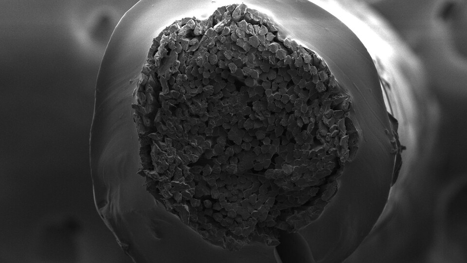 Le nouveau fil de suture vu au microscope électronique à balayage.