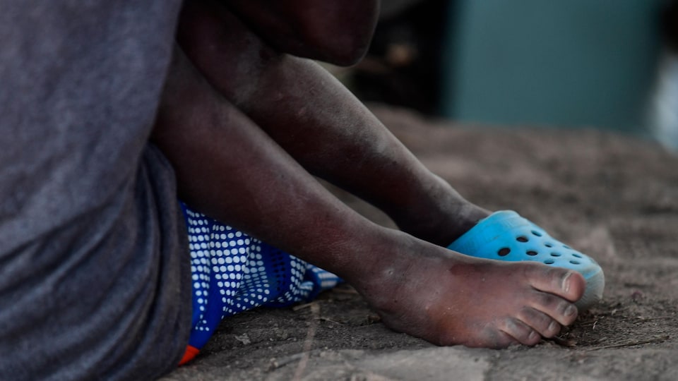 Gros plan des pieds terreux d'un enfant haïtien qui n'a plus qu'une sandale et qui est assis sur le sol.