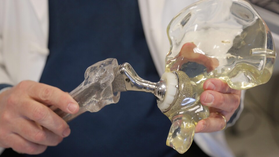 Un modèle d'articulation de la hanche en verre et en métal