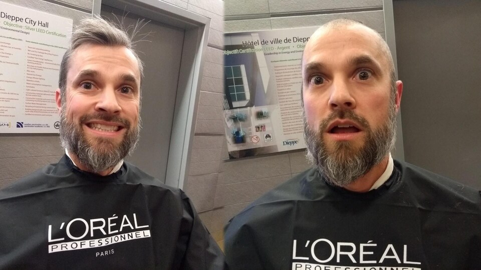 Un homme avec ses cheveux et sur une autre image le même homme sans ses cheveux. 