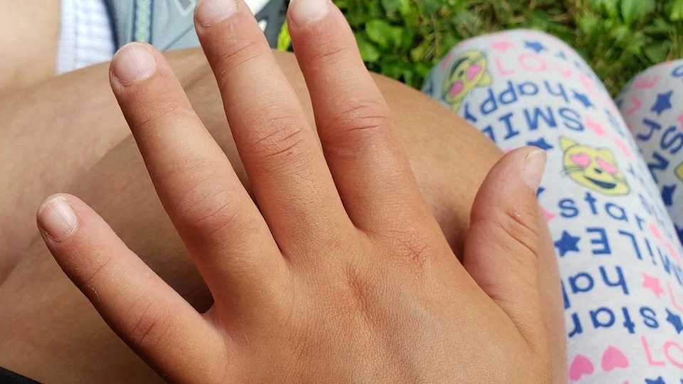 La main de Maria. Sur ses doigts, on voit des marques pâles. 