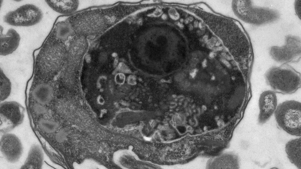 Image microscopique en noir et blanc d'un eucaryote qui a englouti une proie.