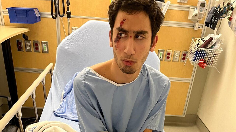 Abdullah Darwich a du sang sur le visage près d'un œil.