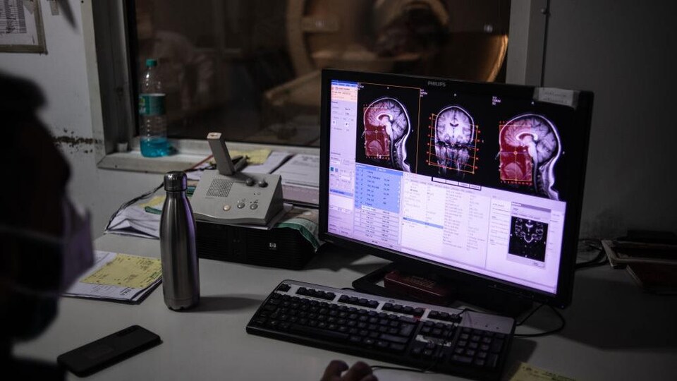 Un homme analyse une image d'un cerveau sur un ordinateur.
