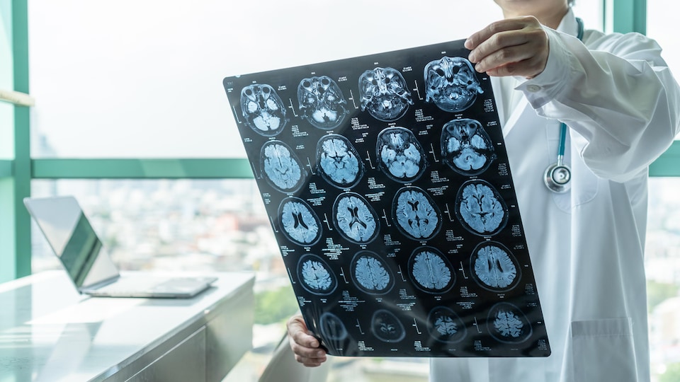 Un médecin analysant une radiographie d'un cerveau.