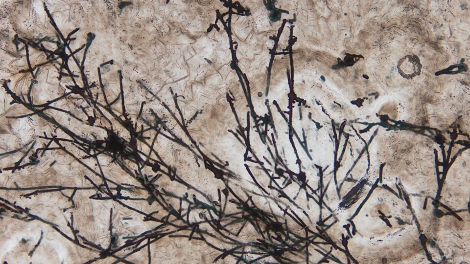 Image microscopique des microfossiles filamenteux ressemblant à des champignons.