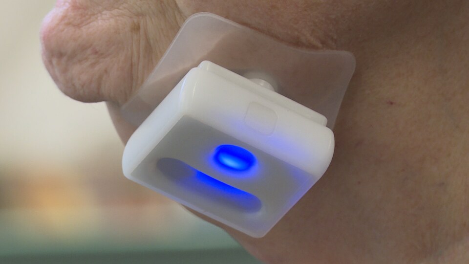 Un dispositif, collé à la gorge d'un patient, doté de capteurs analysant les muscles de la déglutition.