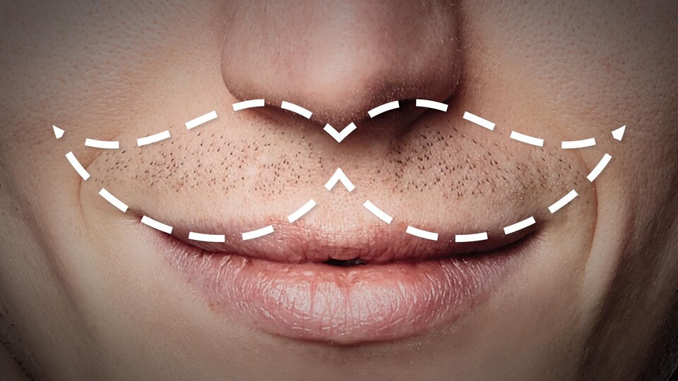 Très gros plan sur le bas du visage d'un homme. Sous le nez, un pointillé en blanc dessinant une moustache.