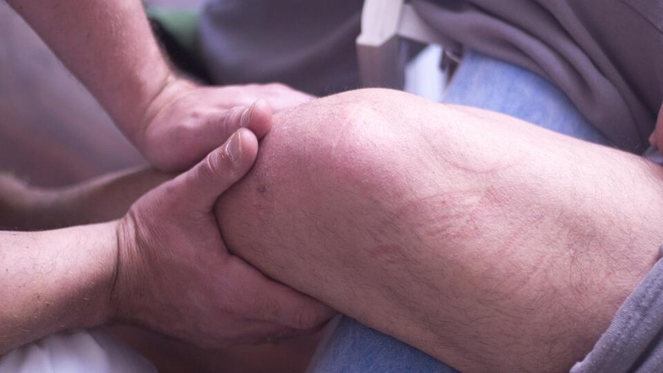 Un homme reçoit un traitement à un genou.