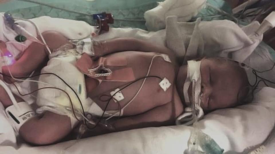 Le petit bébé sur un lit d'hôpital, avec plusieurs fils médicaux sur lui. 