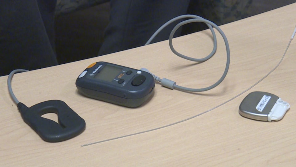 Un stimulateur relié au cerveau pour lutter contre la dépression