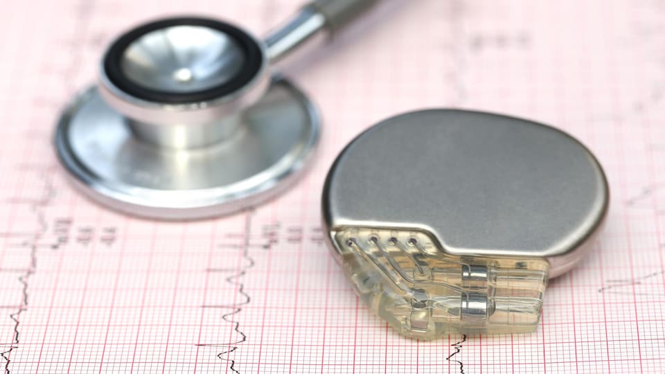 Un gros plan sur un stimulateur cardiaque posé sur une feuille de papier quadrillée, près d'un stéthoscope.