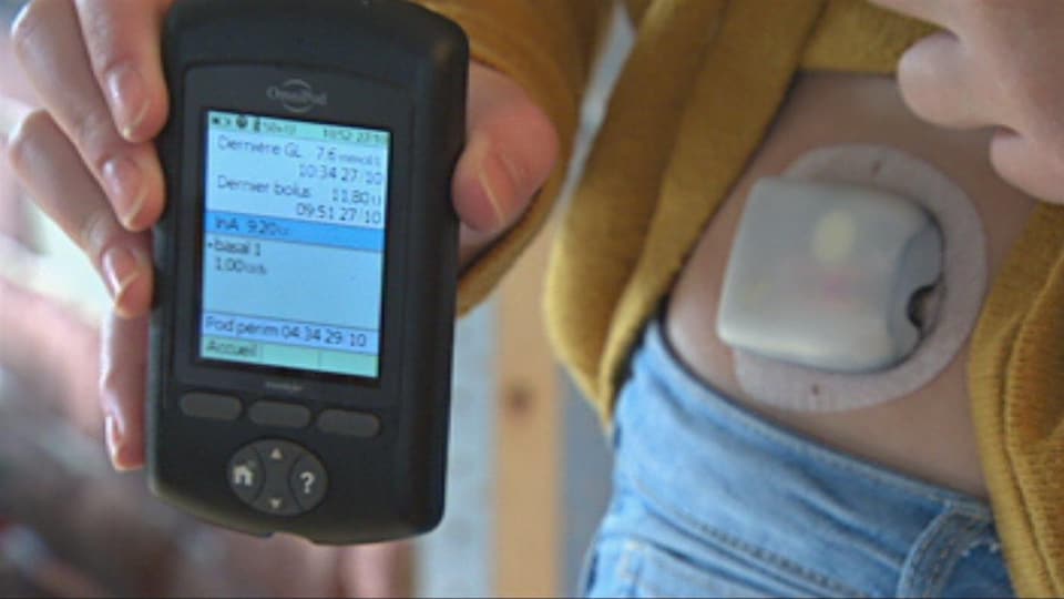Un patient équipé d'une pompe à insuline.