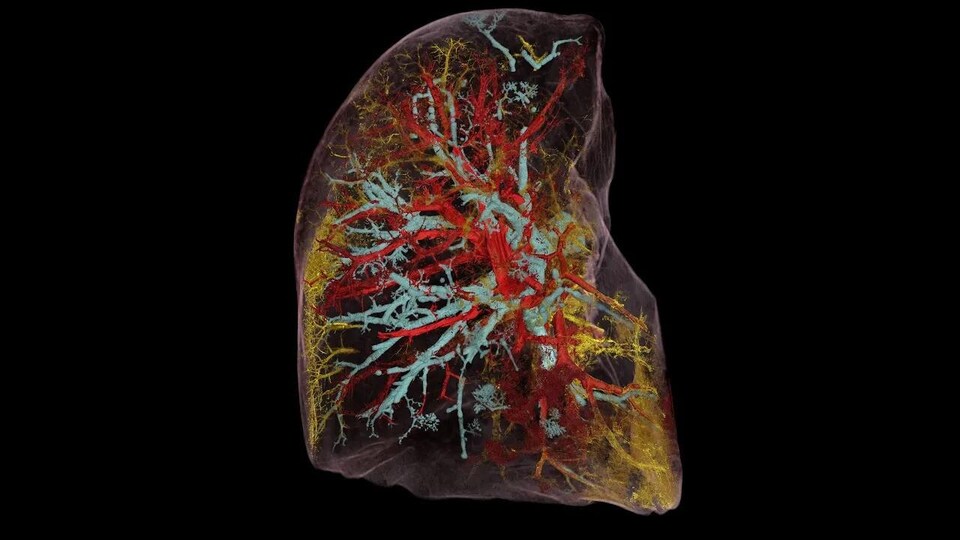 Un poumon dans lequel il est possible de voir les vaisseaux sanguins.