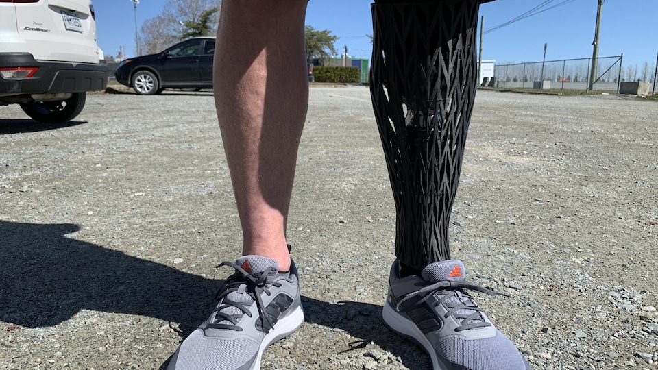Une coquille qui recouvre une prothèse sur une jambe.