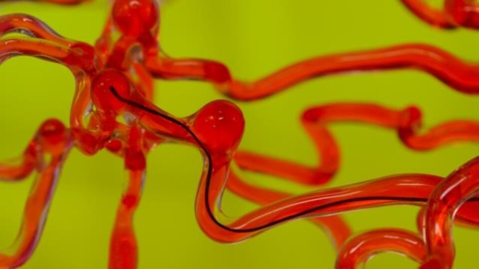 Un fil-robot dans un système vasculaire artificiel.